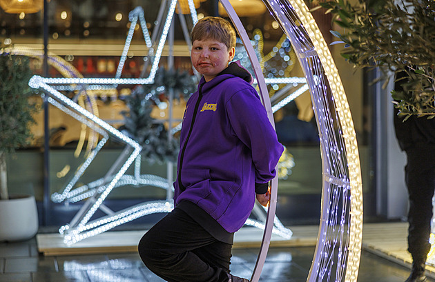 Chlapec z Brněnska se letos podruhé narodil. Přes jizvy od popálenin opět tancuje