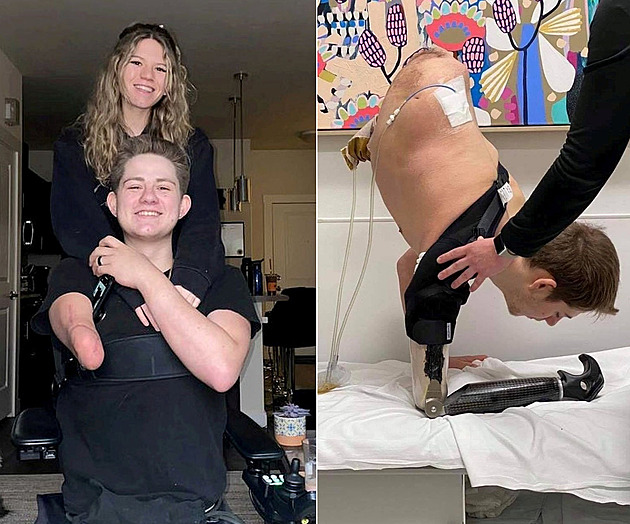 Po nehodě přišel muž o půl těla i ruku, život však nevzdal