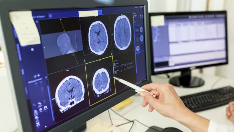 Mozek vám lže, odhalila studie. Upravuje vzpomínky tak, abyste si připadali lepší a schopnější