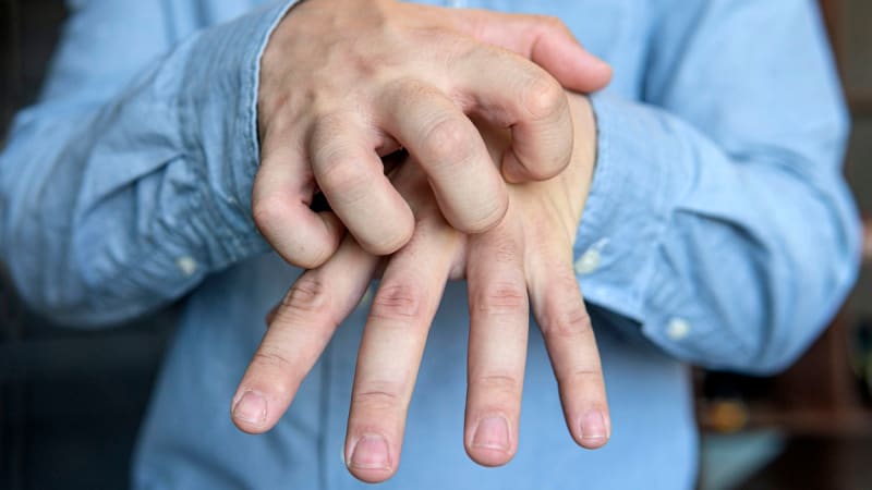 Svrab v Česku trhá rekordy: Nakazit se můžete i v MHD. Jak se chránit?
